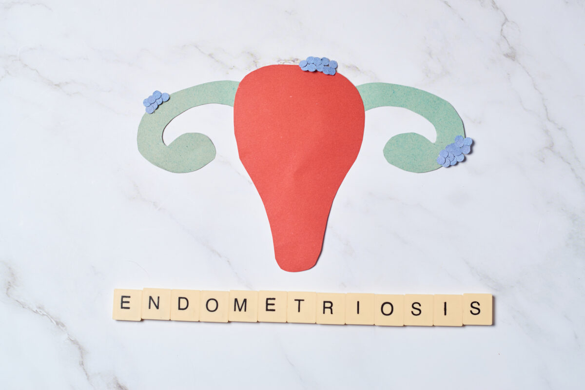 Qué es la endometriosis y cómo afecta la fertilidad